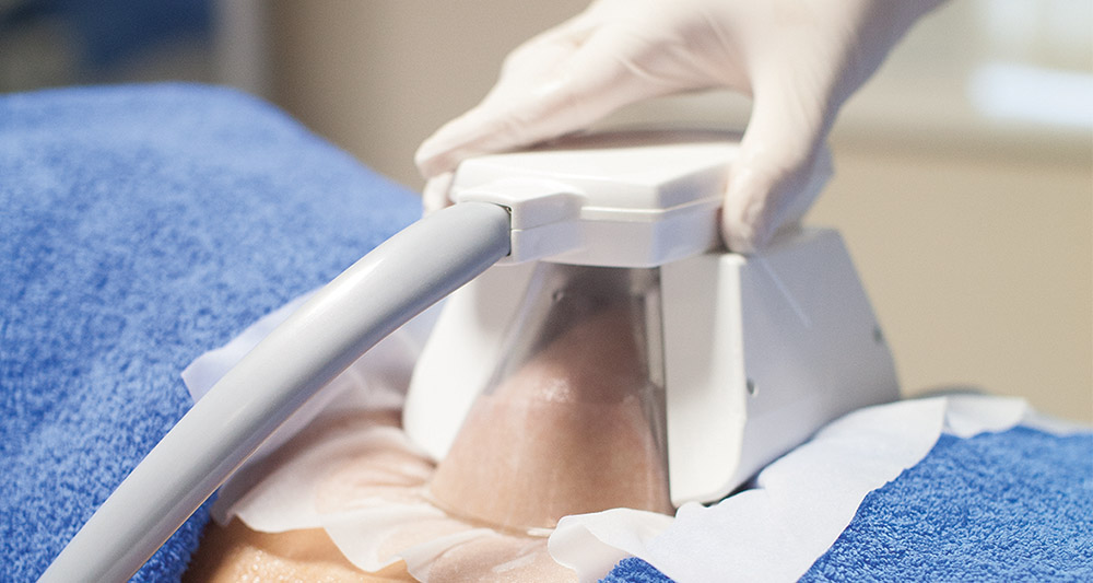 How Fat Freezing and HIFU Work Together? 2 Multiple Areas in One Session HIFU and Fat Freezing Salisbury