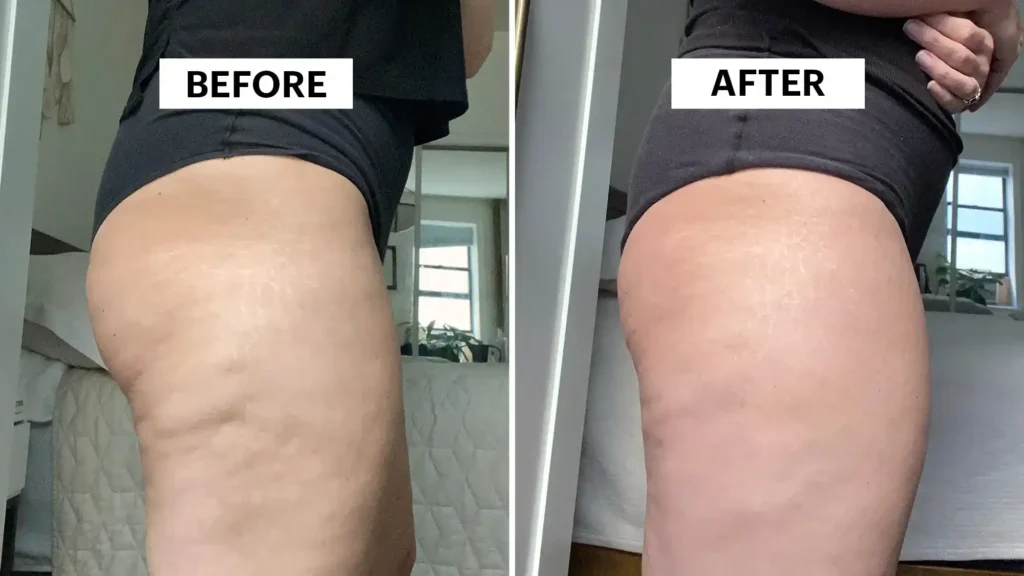 Do Toning Exercise Salisbury Really Tackle Cellulite?