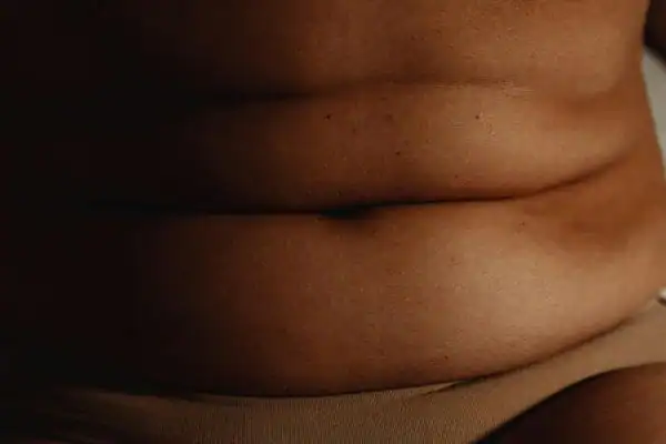 The Hidden Connection: How Stress Shapes Your Fitness and Body Composition 3 image of what stress can do on the stomach area and how Lipo 360 Salisbury can help to change your body shape.