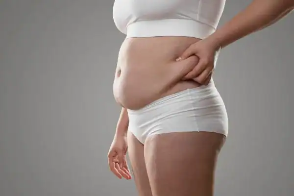 Image of stress belly Salisbury How Lipo 360 can help manage your symptoms